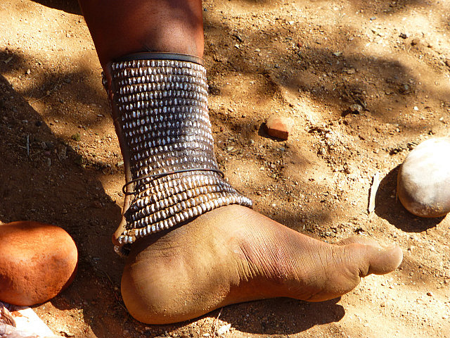 Typical ankle ornamentation of the Himba